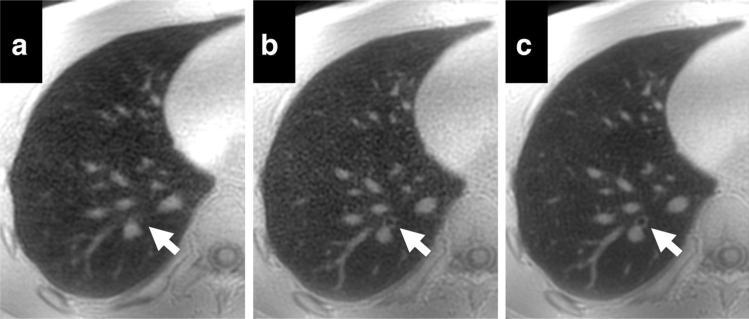 FIG. 7