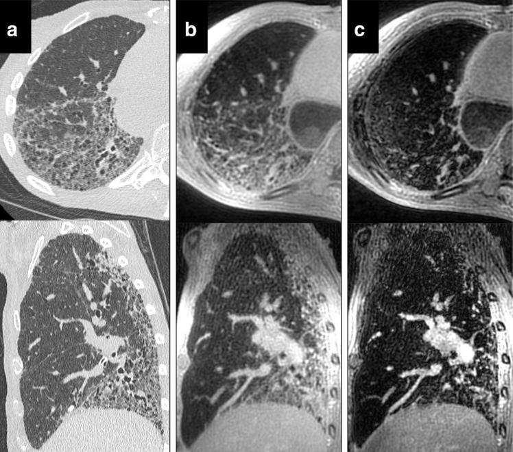 FIG. 8