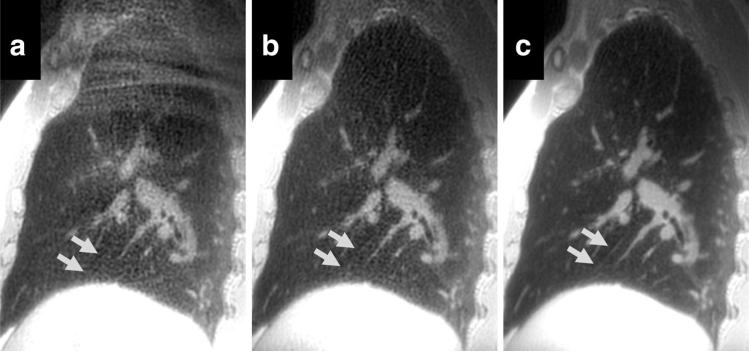 FIG. 6