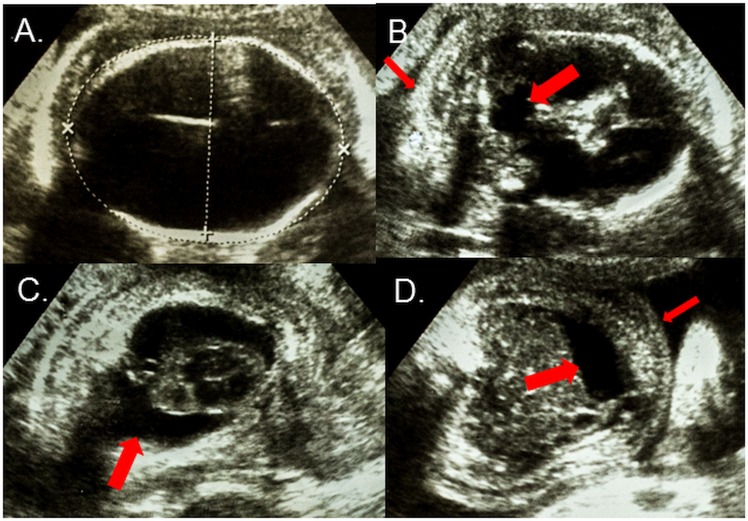 Fig 1