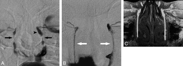 Fig 3.