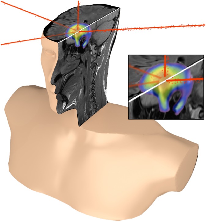 Figure 13.