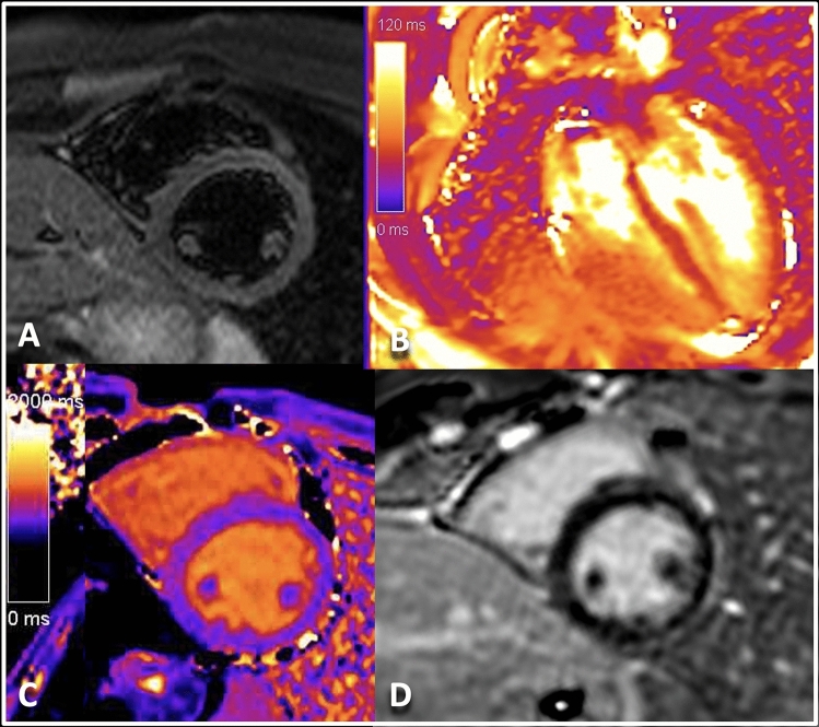 Fig. 2