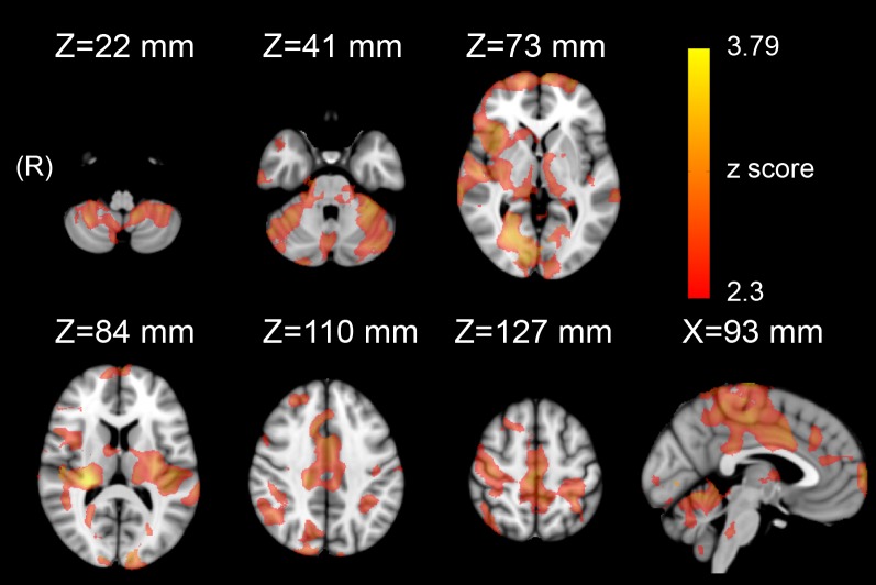 Fig 3