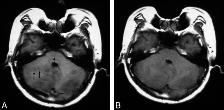 Fig 2.