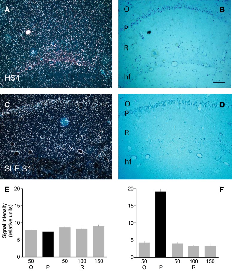 Figure 11.