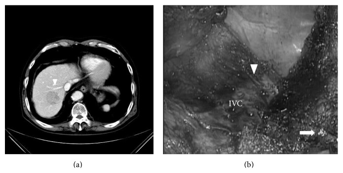 Figure 13