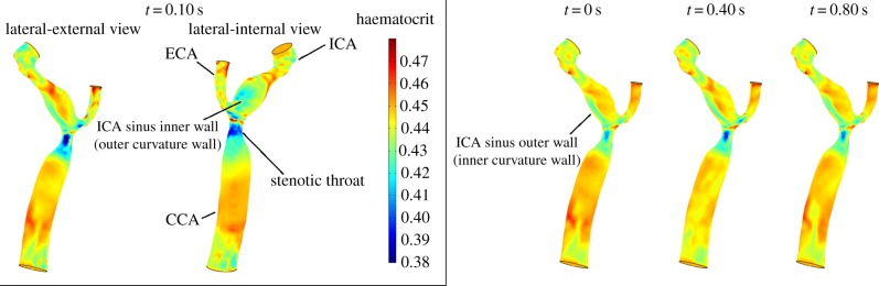 Figure 11.