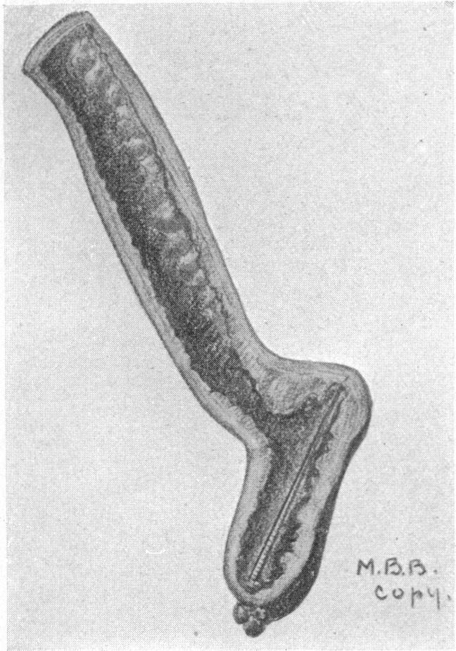 FIG. 13.