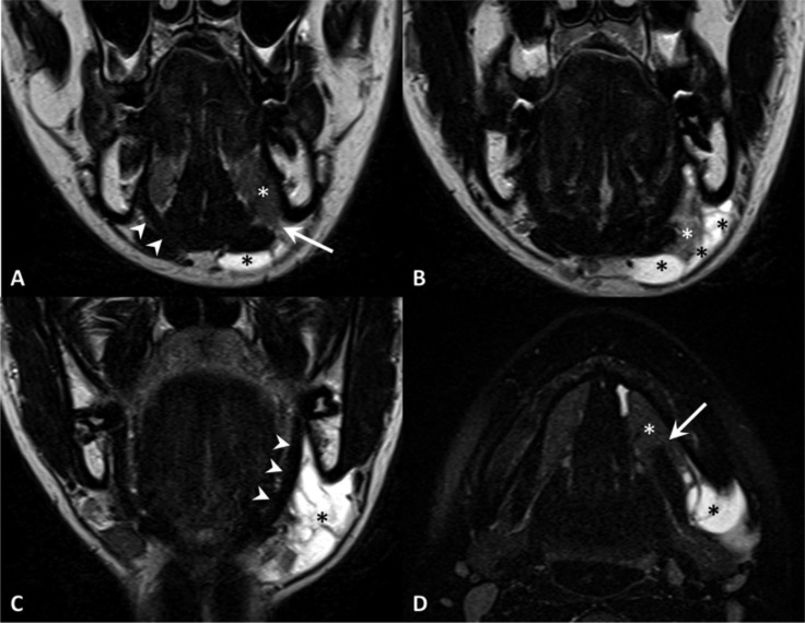 Fig. 11.