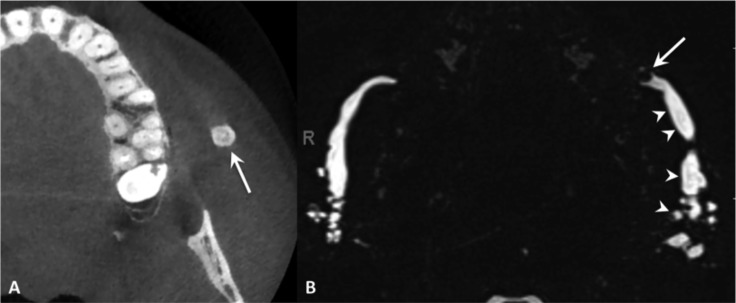 Fig. 9.