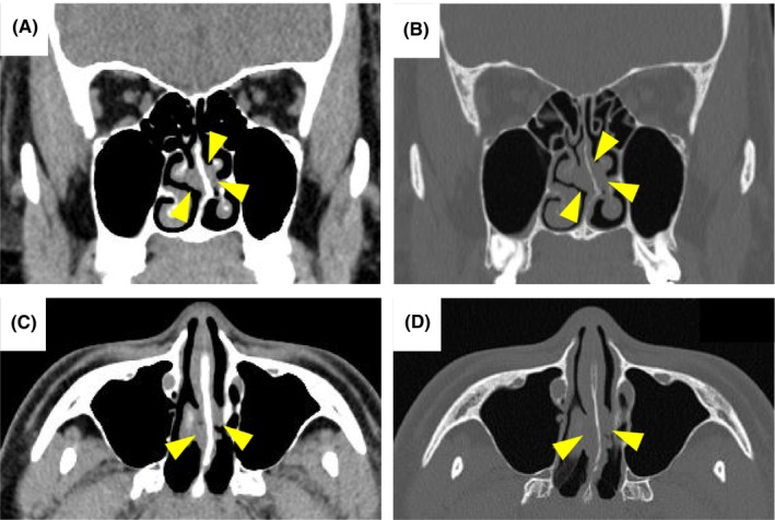 FIGURE 1