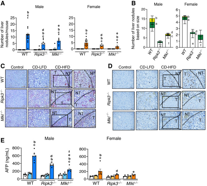 Figure 5. Deleting either Ripk3 or Mlkl significantly reduced HCC in response to a CD-HFD. A, Tumor nodules in the livers of WT, Ripk3−/−, and Mlkl−/− male mice (left) and female mice (right). B, Graphical representation of large (>5 mm, yellow), medium (2–4 mm, green), and small (<1 mm, white) liver nodules in male (left) and female (right) mice [aWT small tumor (ST) vs. WT medium tumor (MT), P < 0.0001; bWT ST vs. WT large tumor (LT), P < 0.0001; cMlkl−/− ST vs. Mlkl−/− MT, P < 0.01; dMlkl−/− ST vs. Mlkl−/− LT, P < 0.01; eWT ST vs. Ripk3−/− ST, P < 0.0001; f WT ST vs. Mlkl−/− ST, P < 0.03]. IHC staining for glypican-3 (C) and Ki-67 (D) in the non-tumor (NT) and tumor (T) of liver sections from male mice. Dark red color in tumor (T) region indicate positive staining for glypican-3 and dark brown spots in tumor region indicate positive staining for Ki-67. Scale bar: 50 μm. E, Circulating AFP levels male (left) and female (right) mice. Males: NC (white), CD-LFD (light blue) or CD-HFD (dark blue). Females: NC (white), CD-LFD (light orange) or CD-HFD (dark orange).