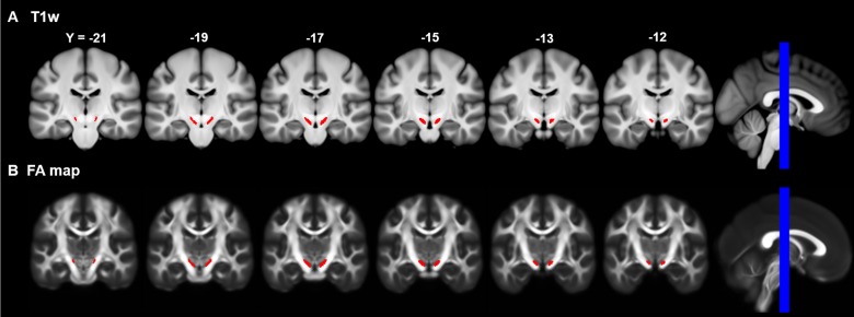 Figure 1—figure supplement 1.