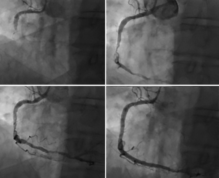 Figure 4: