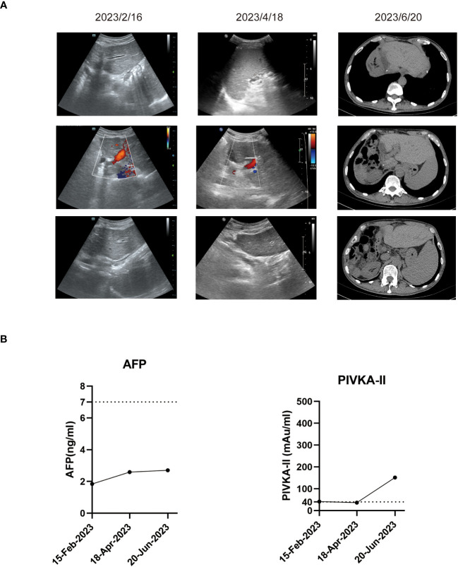 Figure 4