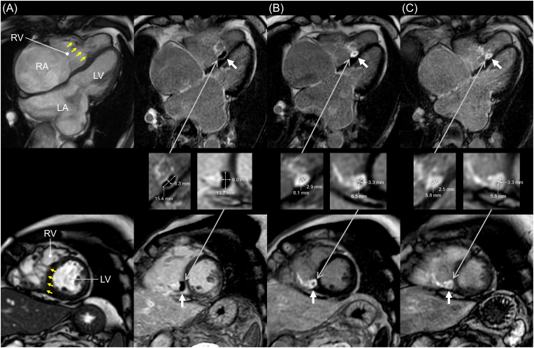 Fig. 2