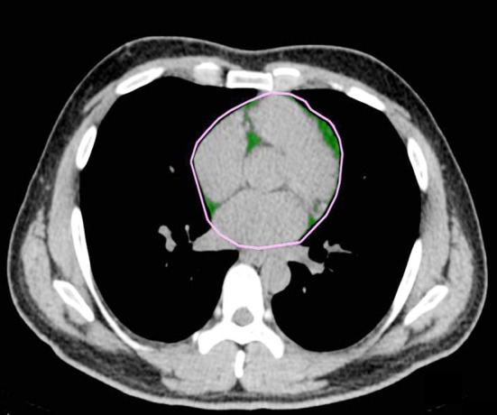 Fig.1