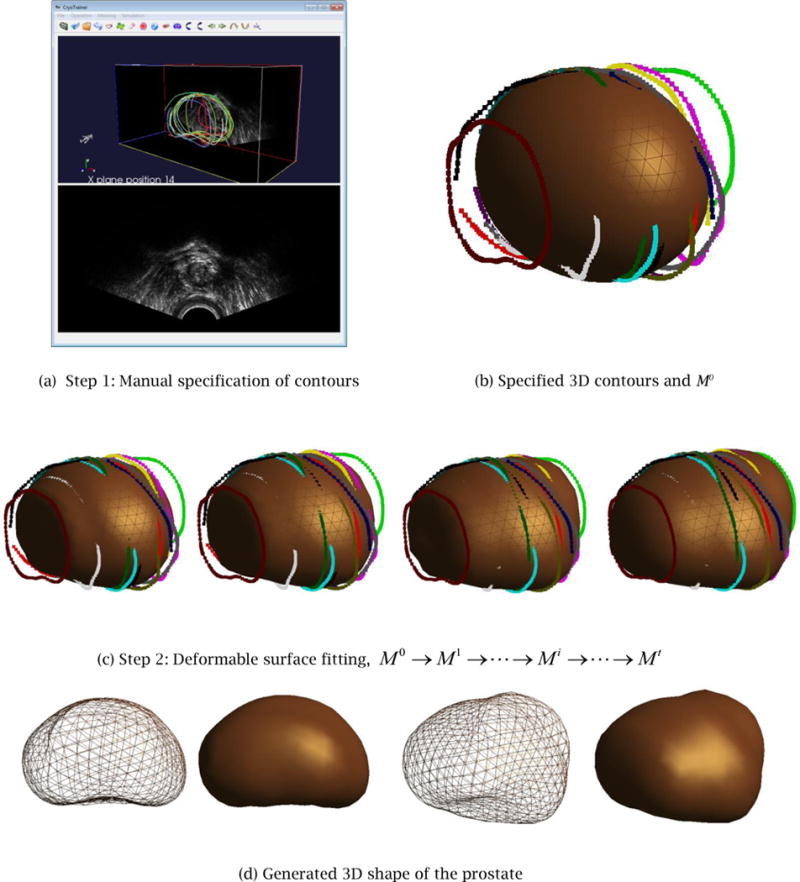 Figure 14