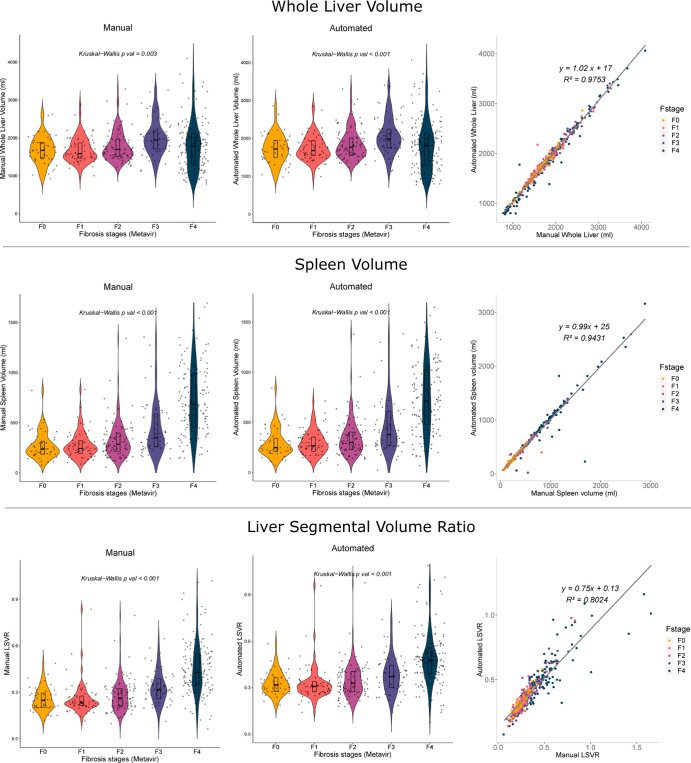 Graphs show manual and automated liver and spleen volume measurements in dataset 1. Manual measurements (left column) and automated measurements (center column) of dataset 1. The whole liver volume (first row), spleen volume (second row), and liver segmental volume ratio (LSVR) (third row) across different METAVIR fibrosis stages are shown. The slopes of the regression line between the manual and automated values are close to 1 in the whole liver and spleen volume (right column). The values across the fibrosis stages show a similar pattern between the manual measurements and automated measurements. Although all values were significantly different between the fibrosis stages (P < .01), only spleen volume and LSVR show a gradual increasing pattern in higher fibrosis grades. Manual and automated measurements were performed in all 406 patients of dataset 1. Box plot inside the violin plot represents the median and first and third interquartile values. LSVR was calculated as the volume ratio of Couinaud segments I–III to segments IV–VIII.