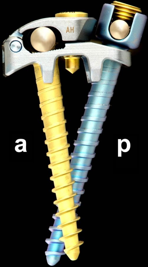 Fig. 1