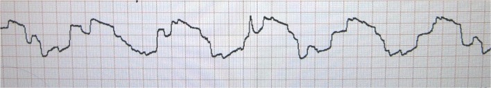 Fig. 2