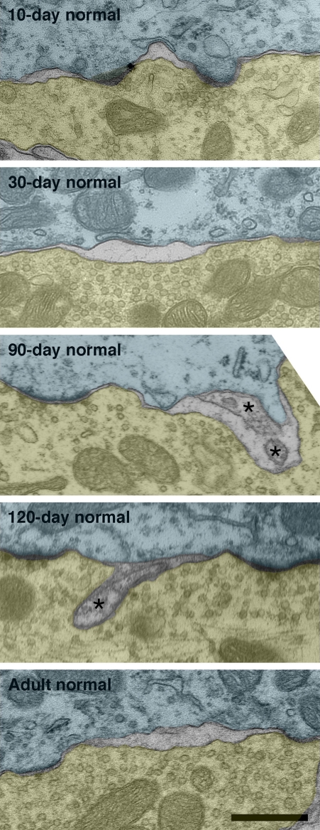 Figure 13