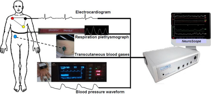 FIGURE 12