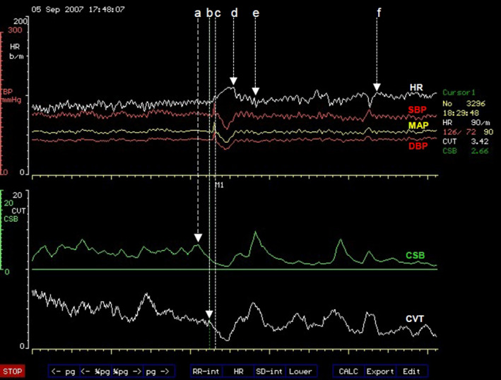 FIGURE 1