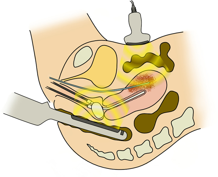 Figure 1