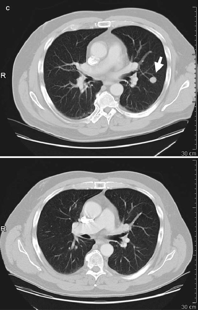 FIG. 1