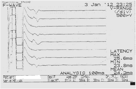 Fig. 2