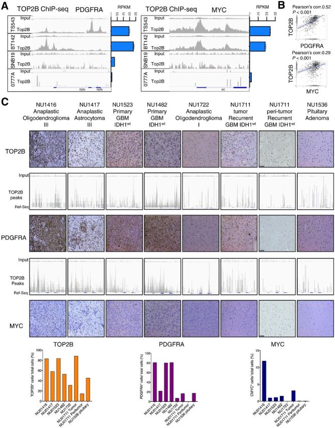 Figure 4. TOP2B expression and genomic localization at PDGFRA and MYC loci is associated with the expression of these genes in human gliomas. A, ChIP-seq for TOP2B native binding (DMSO ChIP; left) and RNA-seq data (right) shows genomic binding and expression of PDGFRA (left) and MYC (right) across human glioma cell lines. ChIP-seq tracks presented are representative of the following experimental replicates: TS543 (n = 2), BT142 (n = 2), 0777A (n = 1), and SNB19 (n = 2). B, Correlation of expression between TOP2B versus PDGFRA mRNA (top) and TOP2B vs. MYC mRNA (bottom) in human gliomas (including low-grade gliomas and GBM) from TCGA GlioVis portal http://gliovis.bioinfo.cnio.es/) determined by Pearson coefficient. C, ChIP-seq for TOP2B at the PDGFRA and MYC loci performed in a set of different glioma human specimens and a sample of peritumoral brain, as well as a pituitary adenoma paired with expression of these proteins determined by IHC (top), and is respective quantification shown in bar plots (bottom). Expression of these proteins were determined by IHC. The slides were quantified for the positive cells and normalized per total cell number for TOP2B, PDGFRA and MYC using HistoQuest version 6.0 software (TissueGnostics). Same y-axis scale was used for input and for the corresponding ChIP track in all cases.