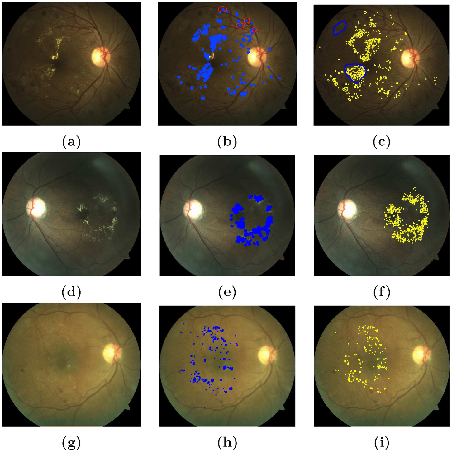 Fig. 11.