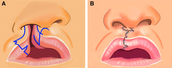 Fig. 2.