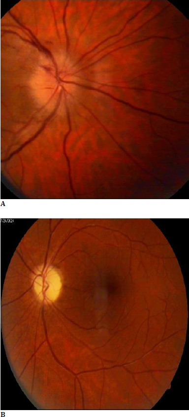 Fig. 1A