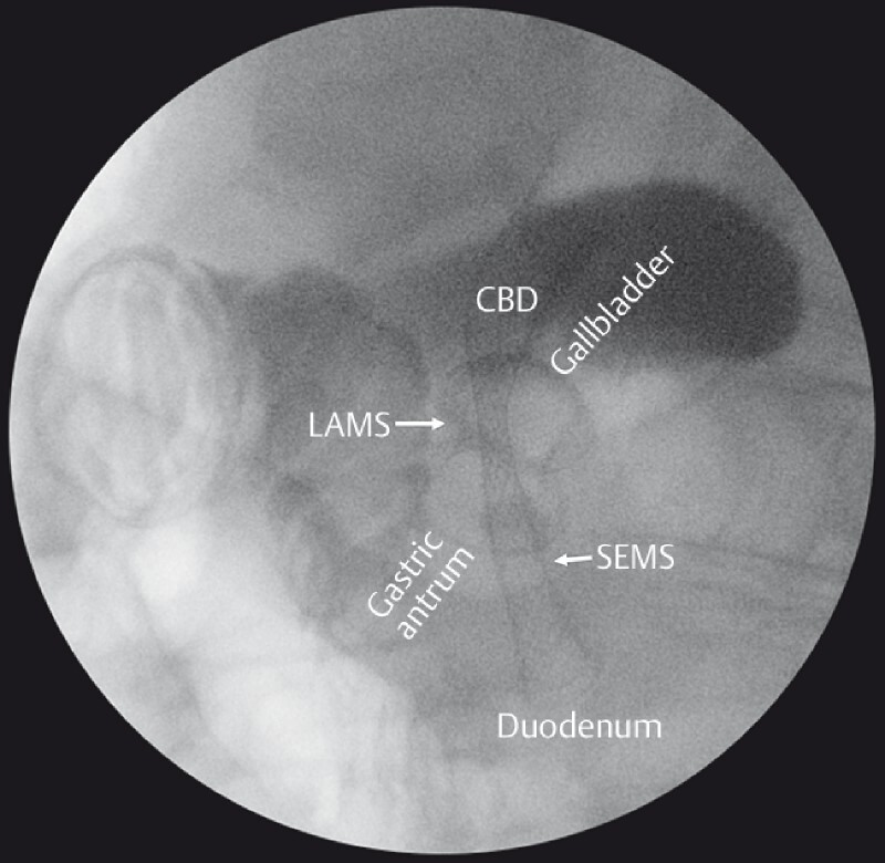 Fig. 5