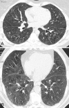 Fig. 2a, b