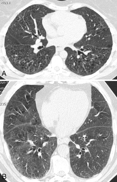 Fig. 2a, b