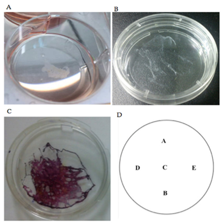 Figure 11