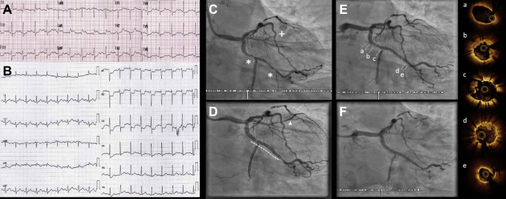 Figure 2