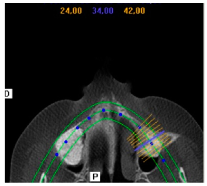 Figure 6