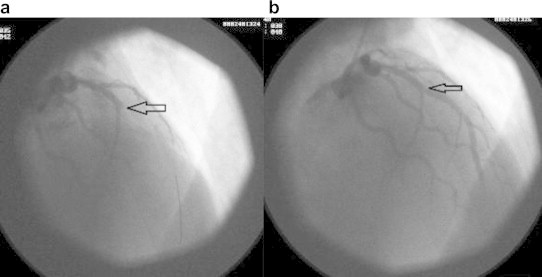 Fig. 4