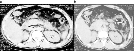 Fig. 3