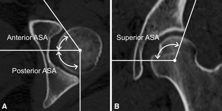 Fig. 3A–B