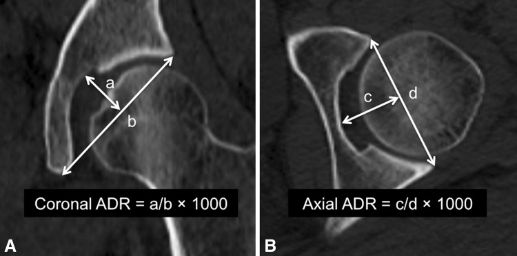 Fig. 4A–B