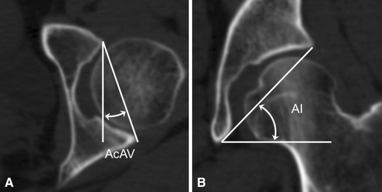 Fig. 2A–B