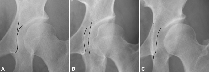 Fig. 1A–C