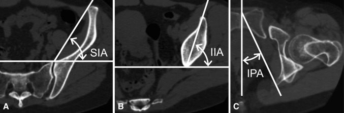 Fig. 6A–C