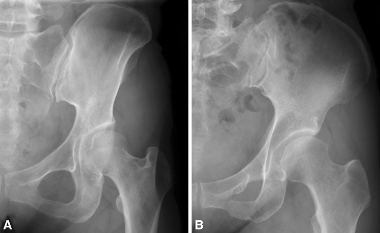 Fig. 7A–B